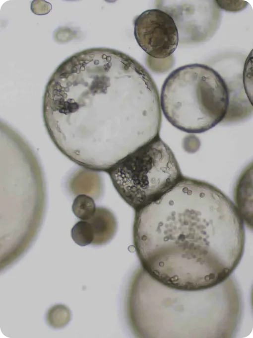 Translucent organoids under a brightfield microscope
