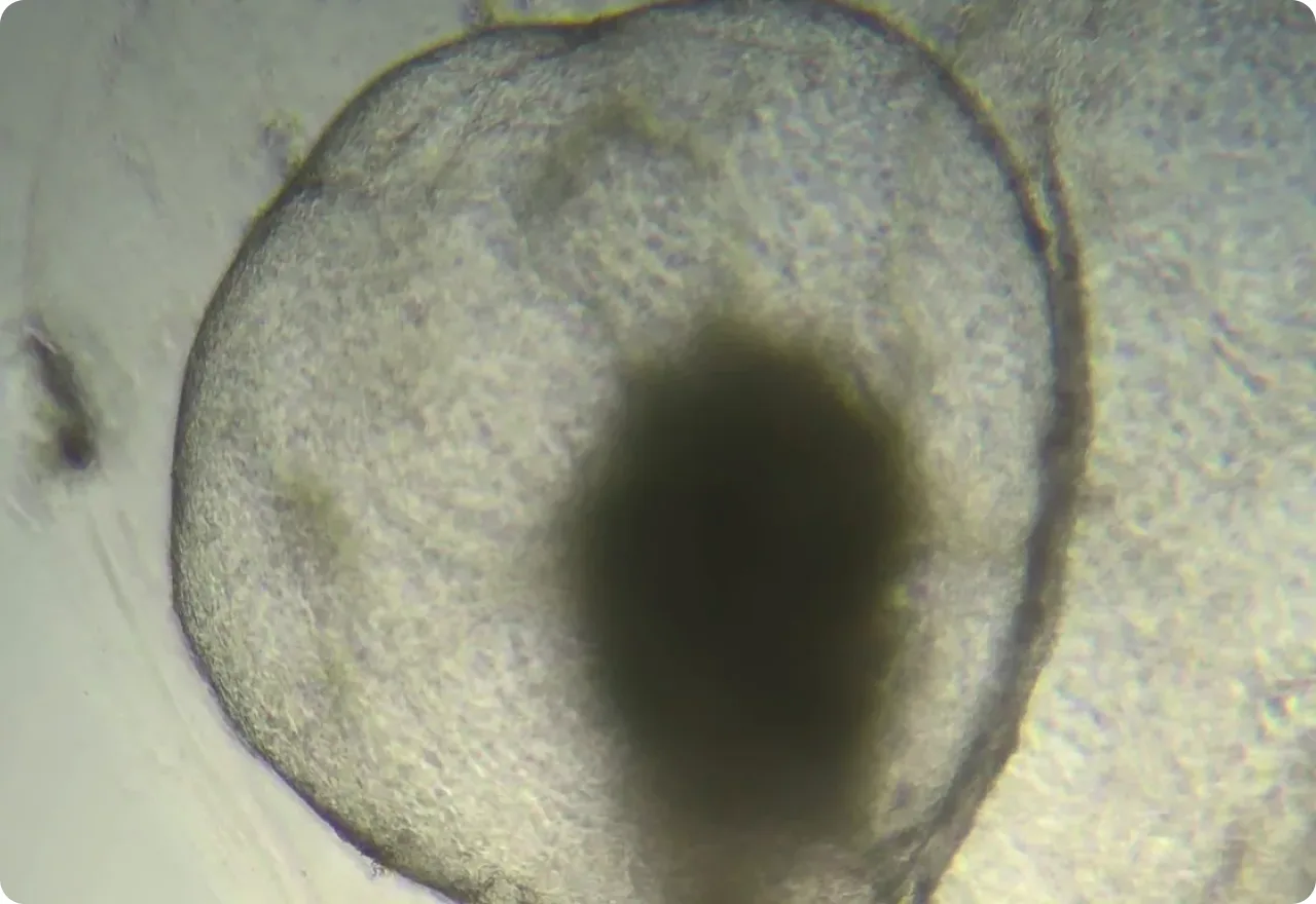 A large organoid in brightfield, its dark core ringed by a translucent cell layer